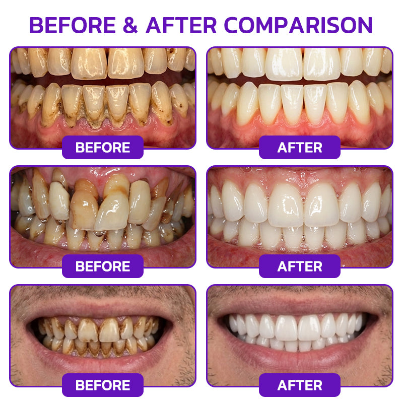 𝟕𝟎% 𝐎𝐅𝐅 | 𝐎𝐅𝐅𝐈𝐂𝐈𝐀𝐋 𝐇𝐄𝐀𝐓𝐖𝐎𝐋𝐅® 𝐒𝐓𝐎𝐑𝐄 | 𝐕𝐢𝐨𝐂𝐨𝐫𝐞 𝐁𝐞𝐞 𝐕𝐞𝐧𝐨𝐦 𝐓𝐨𝐨𝐭𝐡𝐩𝐚𝐬𝐭𝐞 – 𝐀𝐝𝐯𝐚𝐧𝐜𝐞𝐝 𝐆𝐮𝐦 𝐂𝐚𝐫𝐞 𝐟𝐨𝐫 𝐆𝐢𝐧𝐠𝐢𝐯𝐢𝐭𝐢𝐬 & 𝐏𝐞𝐫𝐢𝐨𝐝𝐨𝐧𝐭𝐢𝐭𝐢𝐬