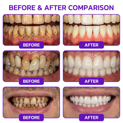 𝟕𝟎% 𝐎𝐅𝐅 | 𝐎𝐅𝐅𝐈𝐂𝐈𝐀𝐋 𝐇𝐄𝐀𝐓𝐖𝐎𝐋𝐅® 𝐒𝐓𝐎𝐑𝐄 | 𝐕𝐢𝐨𝐂𝐨𝐫𝐞 𝐁𝐞𝐞 𝐕𝐞𝐧𝐨𝐦 𝐓𝐨𝐨𝐭𝐡𝐩𝐚𝐬𝐭𝐞 – 𝐀𝐝𝐯𝐚𝐧𝐜𝐞𝐝 𝐆𝐮𝐦 𝐂𝐚𝐫𝐞 𝐟𝐨𝐫 𝐆𝐢𝐧𝐠𝐢𝐯𝐢𝐭𝐢𝐬 & 𝐏𝐞𝐫𝐢𝐨𝐝𝐨𝐧𝐭𝐢𝐭𝐢𝐬