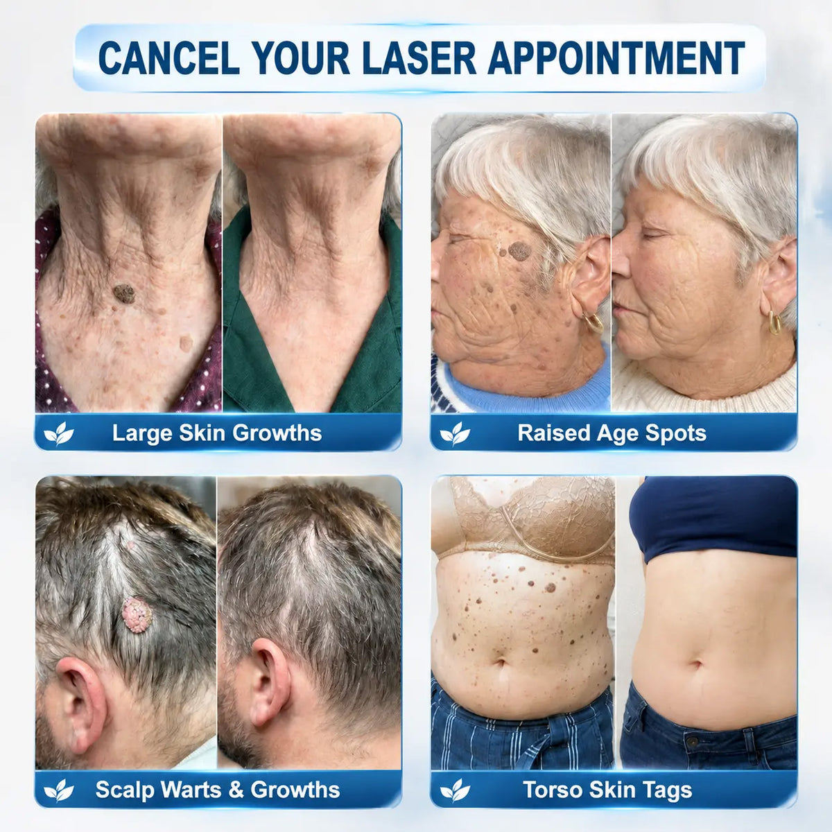 ✨ 7𝟎% 𝐎𝐅𝐅 | 𝐎𝐅𝐅𝐈𝐂𝐈𝐀𝐋 𝐂𝐔𝐑𝐄𝐕𝐈𝐕𝐎®🛡️ 𝐒𝐓𝐎𝐑𝐄 | 𝟕-𝐃𝐚𝐲 𝐒𝐤𝐢𝐧 𝐓𝐚𝐠 & 𝐒𝐩𝐨𝐭 𝐄𝐫𝐚𝐬𝐞𝐫 𝐂𝐫𝐞𝐚𝐦 – 𝐆𝐌𝐏-𝐌𝐚𝐧𝐮𝐟𝐚𝐜𝐭𝐮𝐫𝐞𝐝 𝐁𝐨𝐭𝐚𝐧𝐢𝐜𝐚𝐥 𝐅𝐨𝐫𝐦𝐮𝐥𝐚