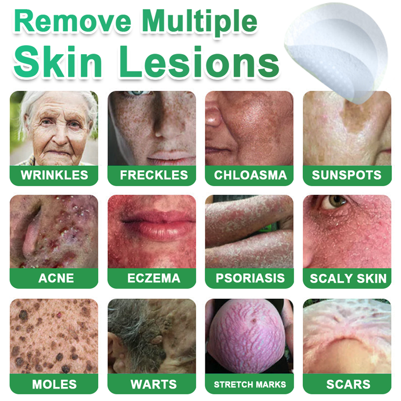 Hudros® 📌2-in-1 Microneedle & Hydrocolloid Pat🧪Raised Moles,Acne,  Flat Warts & Skin Tags Remover | Improves Wrinkles, Scars & Blemishes | Invisible Star Pimple Patches for Face & Body | 144 Count