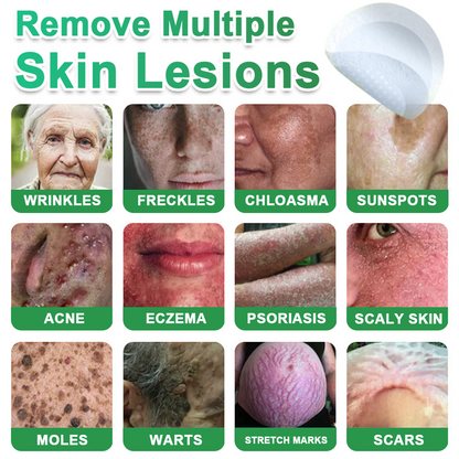 Hudros® 📌2-in-1 Microneedle & Hydrocolloid Pat🧪Raised Moles,Acne,  Flat Warts & Skin Tags Remover | Improves Wrinkles, Scars & Blemishes | Invisible Star Pimple Patches for Face & Body | 144 Count
