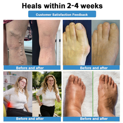 Healrize® Last Day Promotion Enjoy 30% OFF for adding a second one!