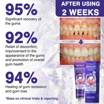 𝟕𝟎% 𝐎𝐅𝐅 | 𝐎𝐅𝐅𝐈𝐂𝐈𝐀𝐋 𝐇𝐄𝐀𝐓𝐖𝐎𝐋𝐅® 𝐒𝐓𝐎𝐑𝐄 | 𝐕𝐢𝐨𝐂𝐨𝐫𝐞 𝐁𝐞𝐞 𝐕𝐞𝐧𝐨𝐦 𝐓𝐨𝐨𝐭𝐡𝐩𝐚𝐬𝐭𝐞 – 𝐀𝐝𝐯𝐚𝐧𝐜𝐞𝐝 𝐆𝐮𝐦 𝐂𝐚𝐫𝐞 𝐟𝐨𝐫 𝐆𝐢𝐧𝐠𝐢𝐯𝐢𝐭𝐢𝐬 & 𝐏𝐞𝐫𝐢𝐨𝐝𝐨𝐧𝐭𝐢𝐭𝐢𝐬