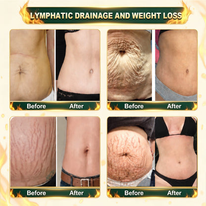 𝐌𝐚𝐝𝐞 𝐢𝐧 𝐔𝐒𝐀丨CureVivo® 💥Advanced Nano Lymphatic Detox & Slimming Patch | Natural Fluid Balance & Body Wellness Support