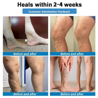 Healrize® Last Day Promotion Enjoy 30% OFF for adding a second one!