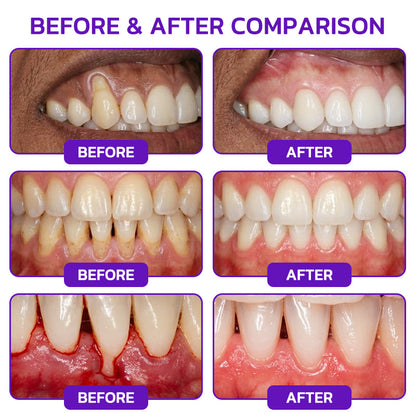 𝟕𝟎% 𝐎𝐅𝐅 | 𝐎𝐅𝐅𝐈𝐂𝐈𝐀𝐋 𝐇𝐄𝐀𝐓𝐖𝐎𝐋𝐅® 𝐒𝐓𝐎𝐑𝐄 | 𝐕𝐢𝐨𝐂𝐨𝐫𝐞 𝐁𝐞𝐞 𝐕𝐞𝐧𝐨𝐦 𝐓𝐨𝐨𝐭𝐡𝐩𝐚𝐬𝐭𝐞 – 𝐀𝐝𝐯𝐚𝐧𝐜𝐞𝐝 𝐆𝐮𝐦 𝐂𝐚𝐫𝐞 𝐟𝐨𝐫 𝐆𝐢𝐧𝐠𝐢𝐯𝐢𝐭𝐢𝐬 & 𝐏𝐞𝐫𝐢𝐨𝐝𝐨𝐧𝐭𝐢𝐭𝐢𝐬