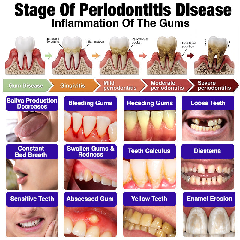 𝟕𝟎% 𝐎𝐅𝐅 | 𝐎𝐅𝐅𝐈𝐂𝐈𝐀𝐋 𝐇𝐄𝐀𝐓𝐖𝐎𝐋𝐅® 𝐒𝐓𝐎𝐑𝐄 | 𝐕𝐢𝐨𝐂𝐨𝐫𝐞 𝐁𝐞𝐞 𝐕𝐞𝐧𝐨𝐦 𝐓𝐨𝐨𝐭𝐡𝐩𝐚𝐬𝐭𝐞 – 𝐀𝐝𝐯𝐚𝐧𝐜𝐞𝐝 𝐆𝐮𝐦 𝐂𝐚𝐫𝐞 𝐟𝐨𝐫 𝐆𝐢𝐧𝐠𝐢𝐯𝐢𝐭𝐢𝐬 & 𝐏𝐞𝐫𝐢𝐨𝐝𝐨𝐧𝐭𝐢𝐭𝐢𝐬
